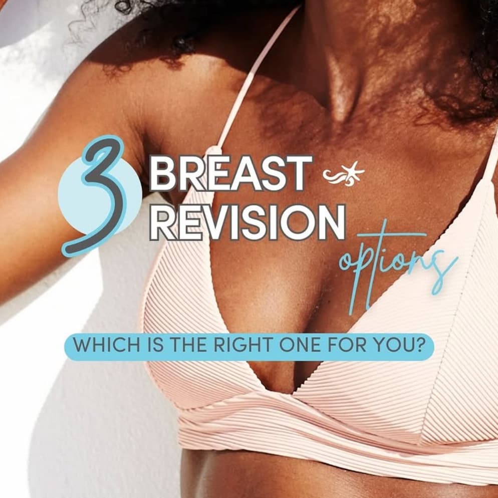 Before-and-after images of a woman’s abdomen and waist showing results 6.5 months after liposuction combined with Renuvion, with a flatter stomach and more contoured shape.