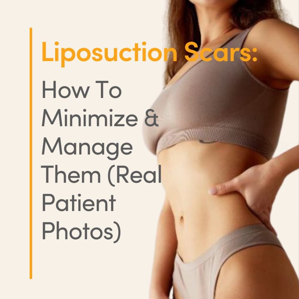 Close-up of a woman’s chest wearing a light pink textured bikini top, with text overlay about three breast revision options.