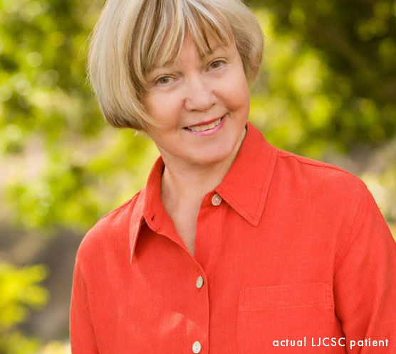 “I wanted to get rid of the jowls and lines that were creeping up on me” – facelift patient