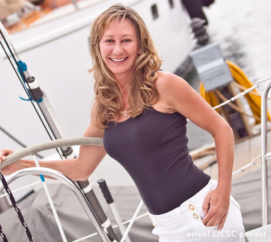 Patient looks great in her 50s: breast augmentation and facelift
