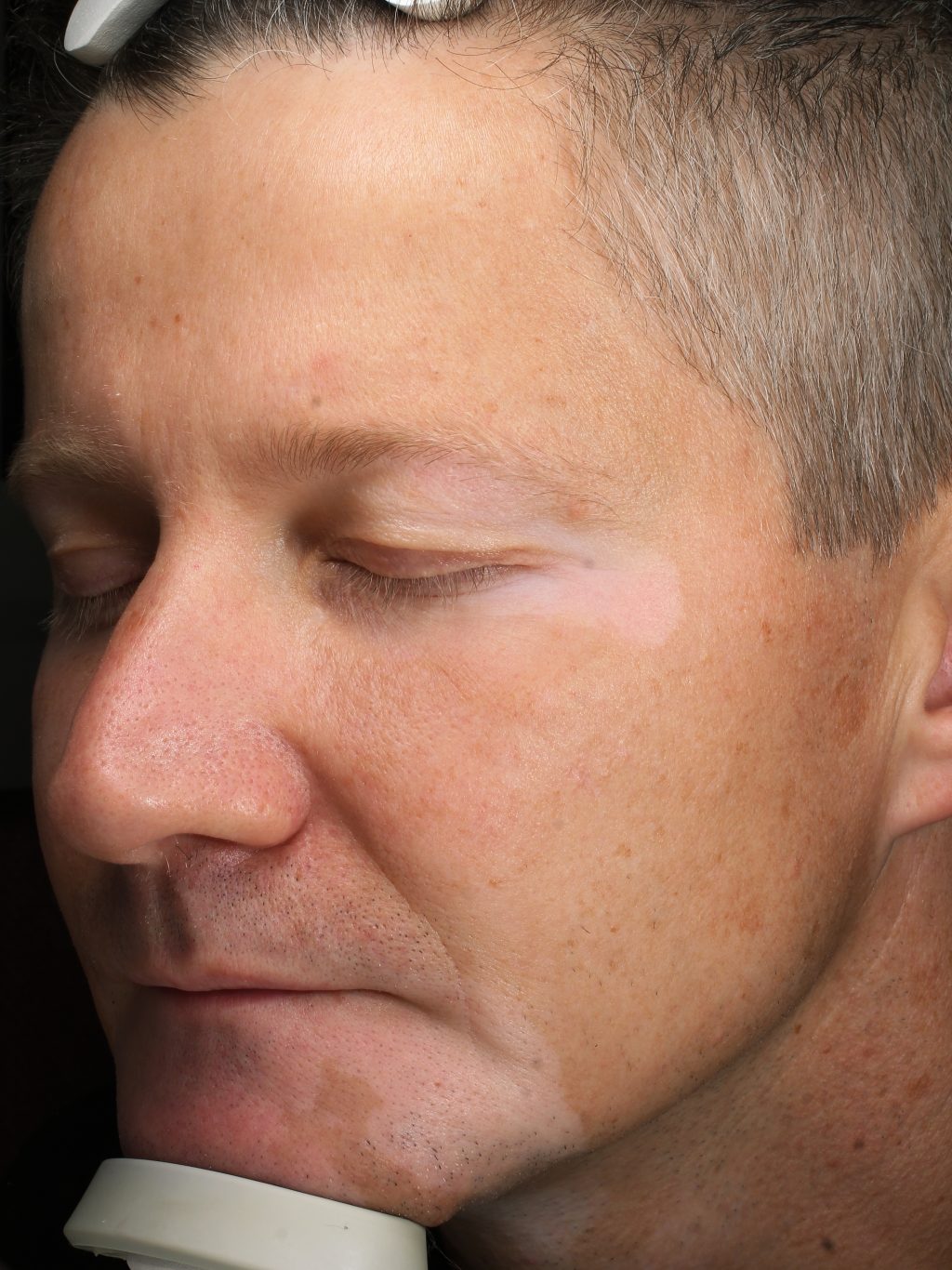 A close-up photo of Dr. Swistun's face in which the texture and pigmentation of his skin are visible