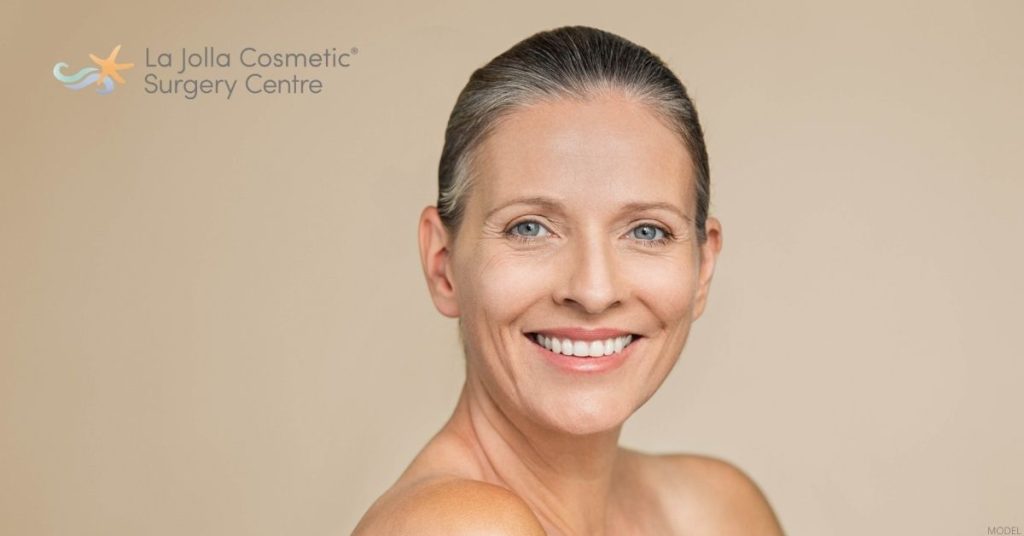 Woman after a facelift. (Model)