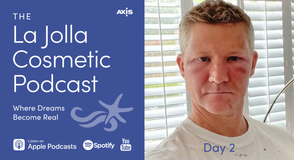 The La Jolla Cosmetic Podcast logo with a photo of Dr. Luke Swistun two days after Halo laser