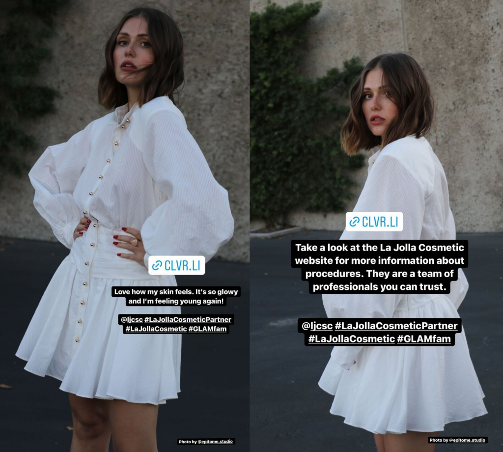 Side-by-side photos of Nadyā posing in a white dress after receiving JUVÉDERM Vollure and JUVÉDERM Ultra Plus treatments