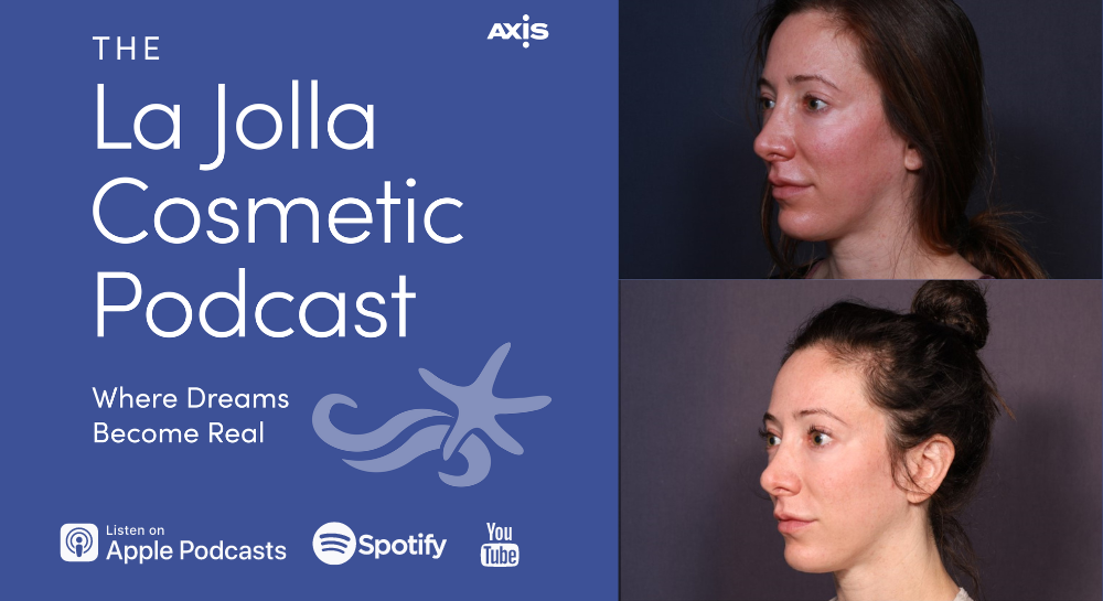 [The La Jolla Cosmetic Podcast | Where Dreams Become Real] Patient Maria before (left) vs after (right) Ultherapy and HALO laser
