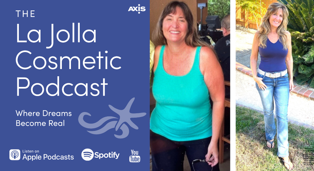 [The La Jolla Cosmetic Podcast | Where Dreams Become Real] Patient Stacy before (left) vs. after her weight loss and surgery (right)