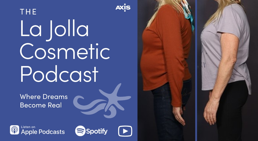 [The La Jolla Cosmetic Podcast cover art] Patient Karen before (left) and after (right) the Signature Skinny Shot program