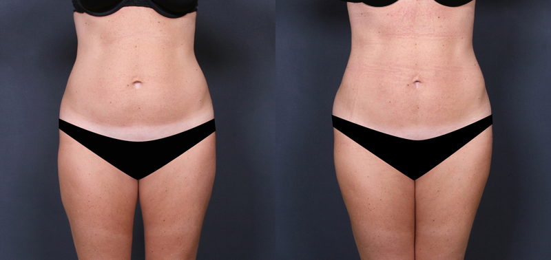 Before and after images