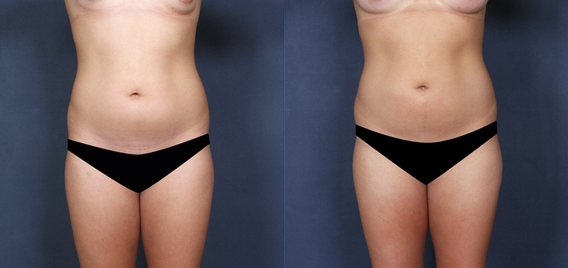 Before and after images