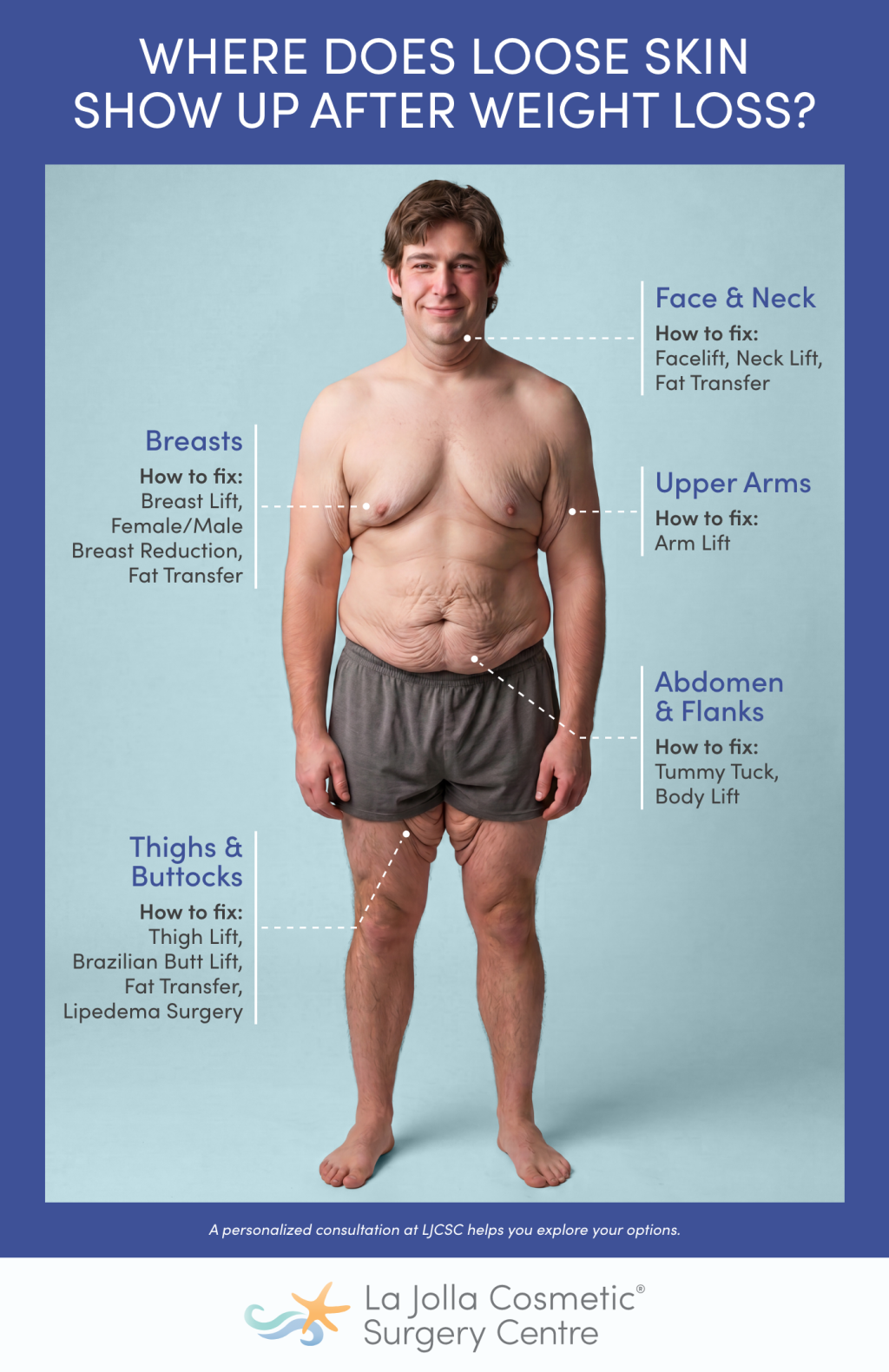 Infographic of loose skin after weight loss and cosmetic surgery options by treatment area.