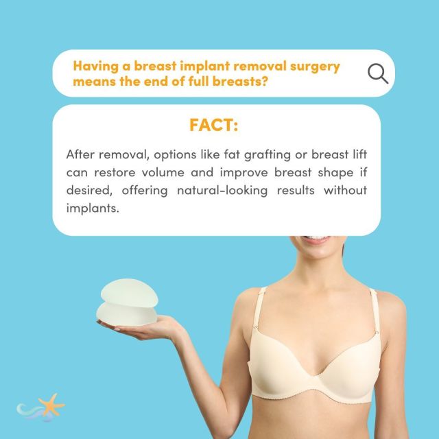 Getting rid of your implants doesn’t mean you have to part ways with a beautiful breast contour! Our explant surgeons use specialized techniques such as fat grafting and breast lift to restore some natural-looking volume and improve shape. ❤️👏
.
#breastimplantremoval #fatgrafting #naturalshape #techniques #breastcontour