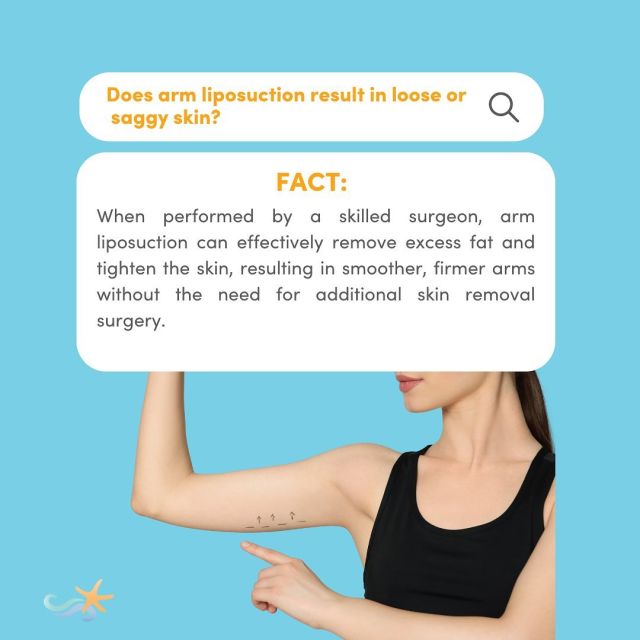 Arm lipo won’t give you saggy skin if done by a pro! 🙌 Plus, an experienced surgeon will know whether your skin elasticity can handle losing some fat without leaving you with a different kind of flab. 💪✨

#armlift #armlipo #armliposuction #surgerycenter #plasticsurgery #surgeon #mythvsfact #mythvsreality