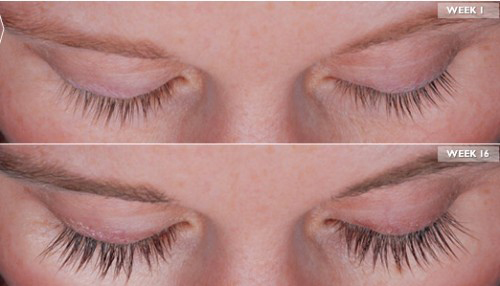 Latisse Eyelash Enhancer