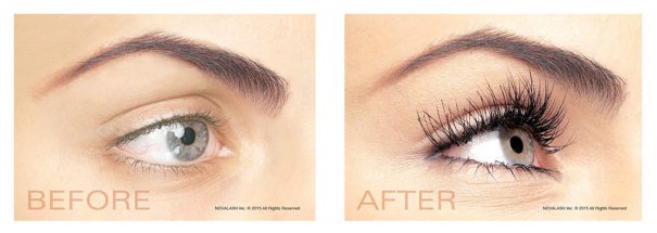 novalash before and after