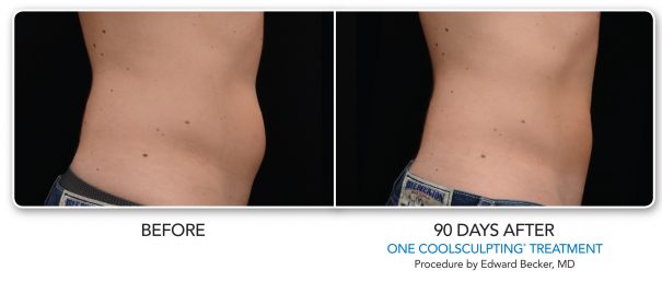 BA-Male-Abdomen-001