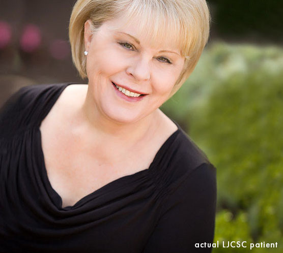 “If you are older, you need a face lift, not a ‘quickie’ cheaper lift” – facelift patient Susie
